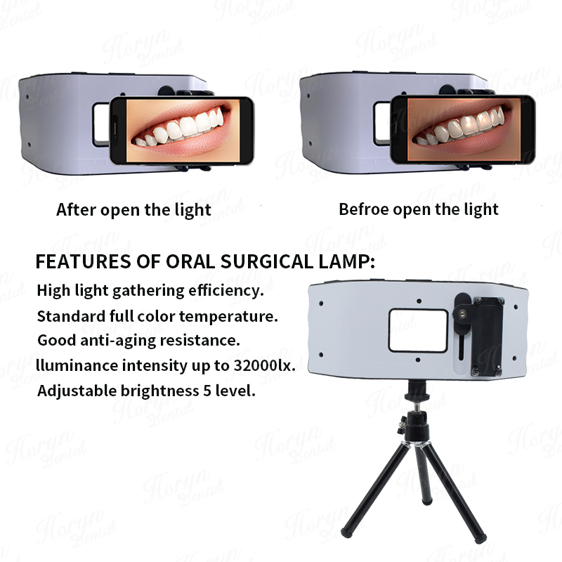 치과 플래시 라이트 사진 장비 치과 LED 구강 충전  - Photography Lighting Equipment 리뷰 및 가격